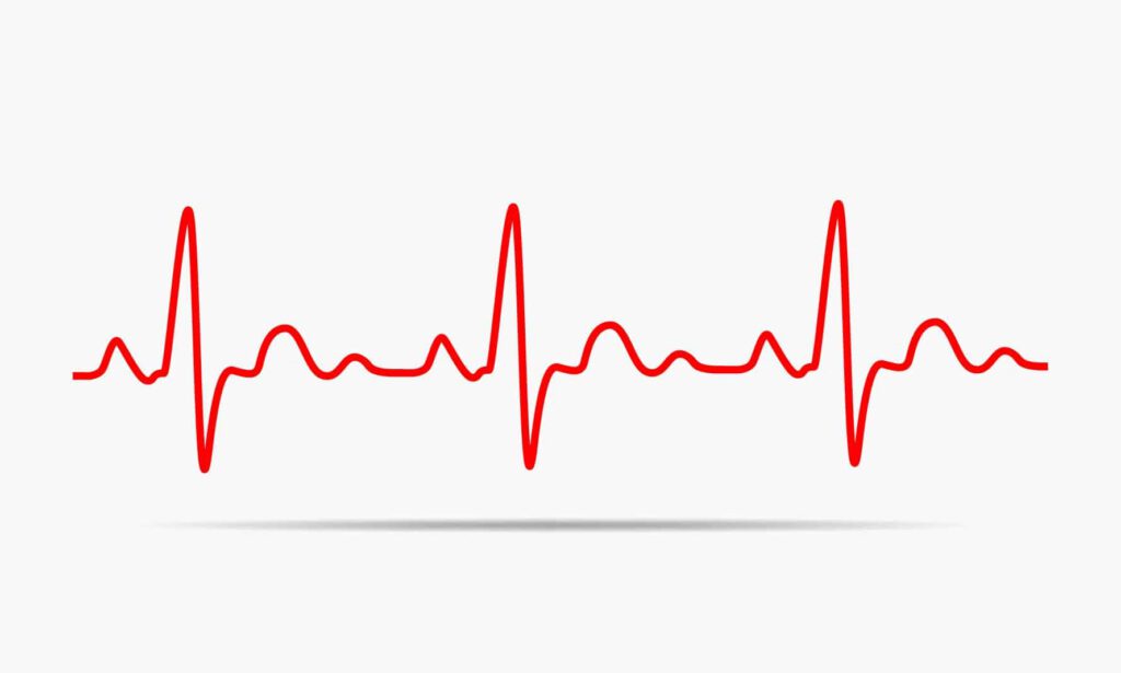 How To Optimize WordPress Heartbeat Without A Plugin
